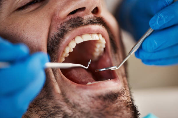 Best Emergency Dental Care for Sports Injuries in Ethete, WY