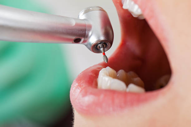 Best Emergency Care for Gum Disease in Ethete, WY